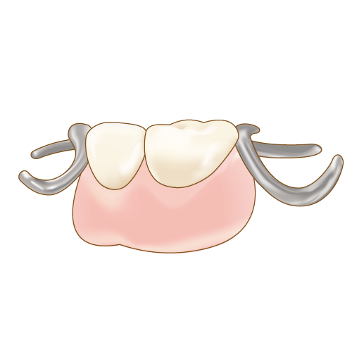 岡山県岡山市北区の歯医者　たんじフレンド歯科　義歯・入れ歯　部分入れ歯